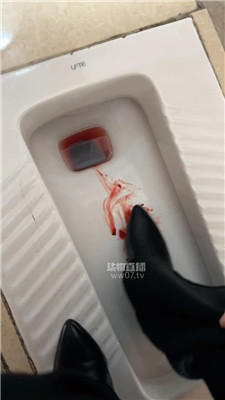 【77夫妻】让狗舔踩了厕所的鞋2.0    251122-1